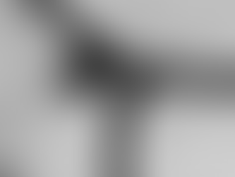 O que é o vírus Marburg, 'primo' do ebola que voltou a preocupar após mortes em Gana