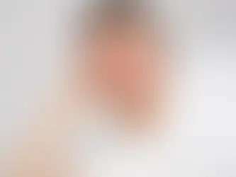 Adesivos para espinha ganham roupagem colorida; saiba se eles funcionam