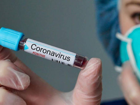 Coronavírus: Cientistas da Fiocruz testam droga contra HIV com sucesso