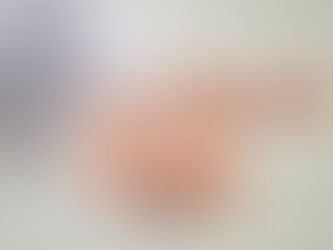 DIU Mirena agora pode ser usado por 8 anos para evitar gravidez, segundo nova decisão da Anvisa