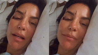 Ivete Sangalo: cantora revela que sofreu queda após uma 'infecção intestinal bem violenta'; entenda a condição