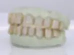 jumbo gold grill side view.webp