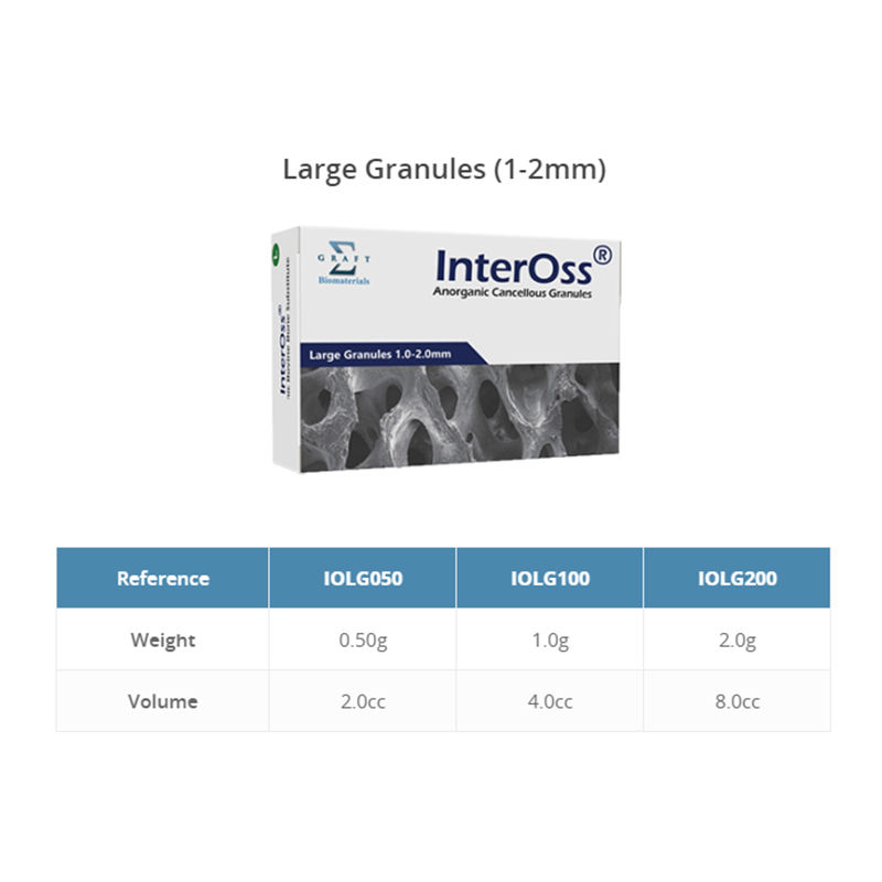 Thumbnail: InterOss Bone Graft (Bovine)