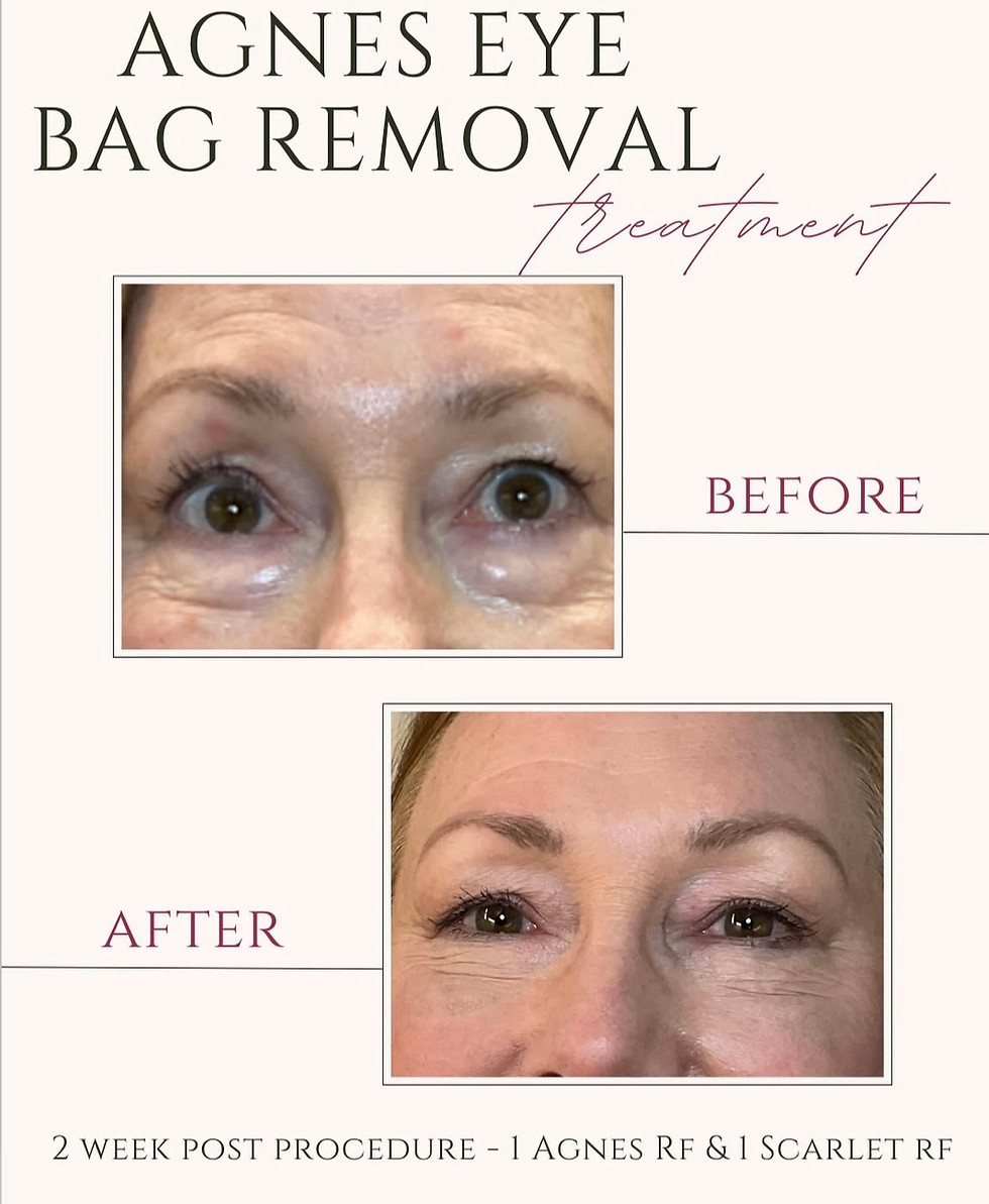Beautiful Aesthetics AZ, Beautiful Aesthetics Med Spa, Beautiful Aesthetics Tempe, Med Spa near me, Aesthetics near me, med s