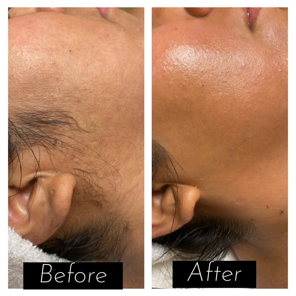 Beautiful Aesthetics AZ, Beautiful Aesthetics Med Spa, Beautiful Aesthetics Tempe, Med Spa near me, Aesthetics near me, med s