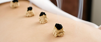 best Moxibustion in Dubai www.acupuncture.com.png