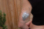 Thumbnail: Diabetic Armour- Omnipod 5/DASH
