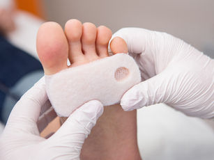 What You Should Know About Skin Substitutes