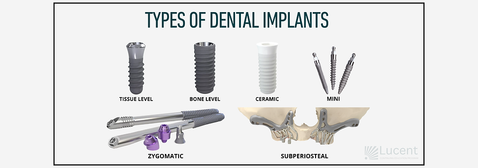 The key takeaway from this sample slide for the Dental Implants 101 - Introduction to Dental Implants and Digital Workflows session is to review the types of dental implants.