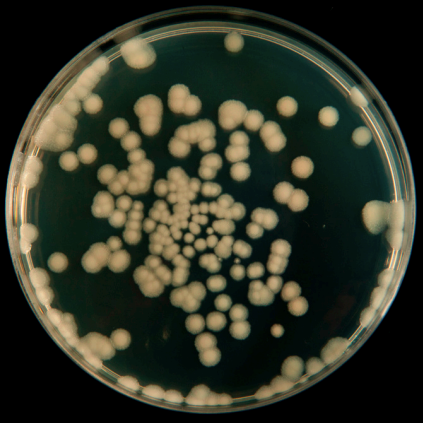 Analizar camarones sanos y observar diferencias entre ellos y los enfermos no significa que los microbiomas de los organismos sanos sean responsables de su salud.