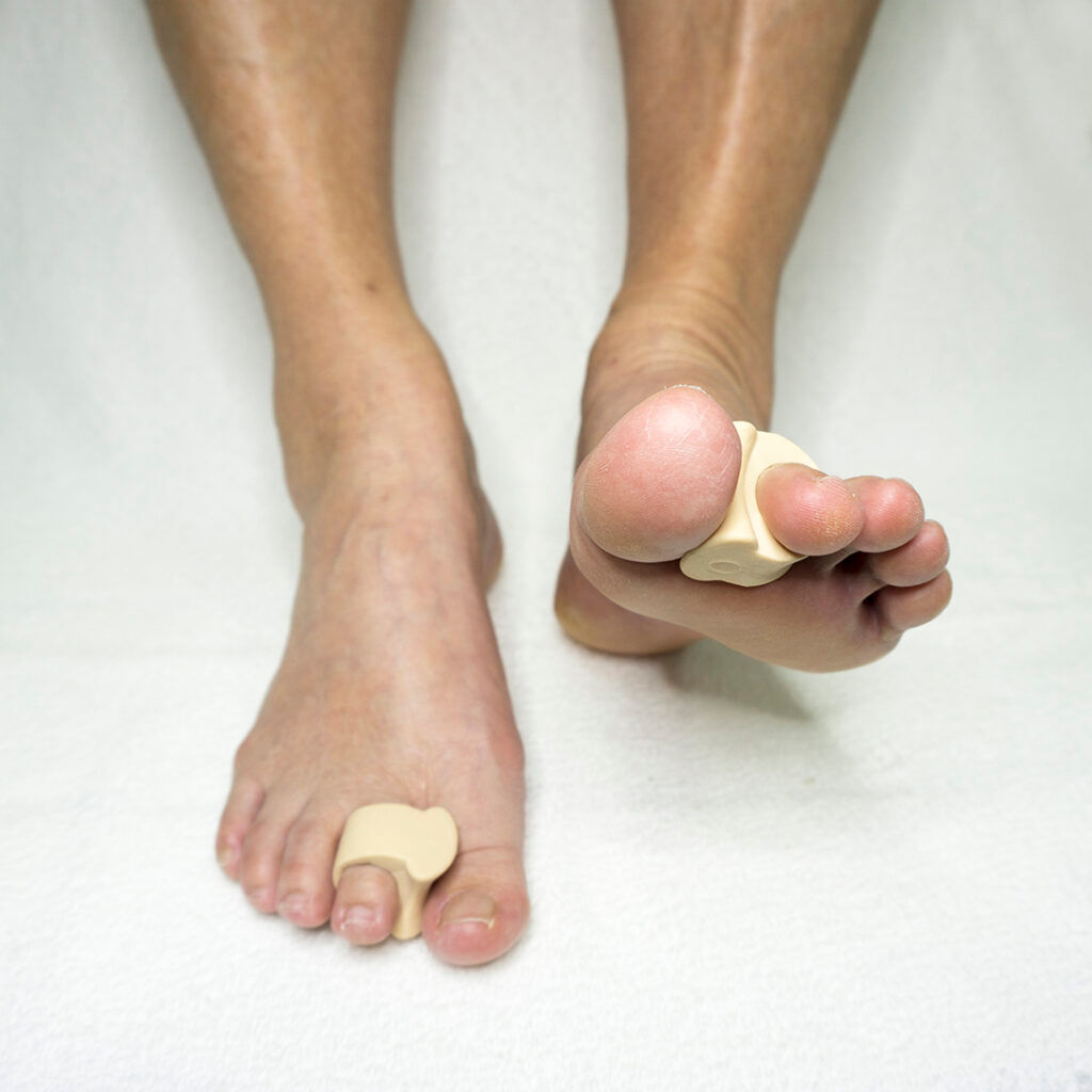 Pedisil – Zilver Hallux Valgus Teencorrector