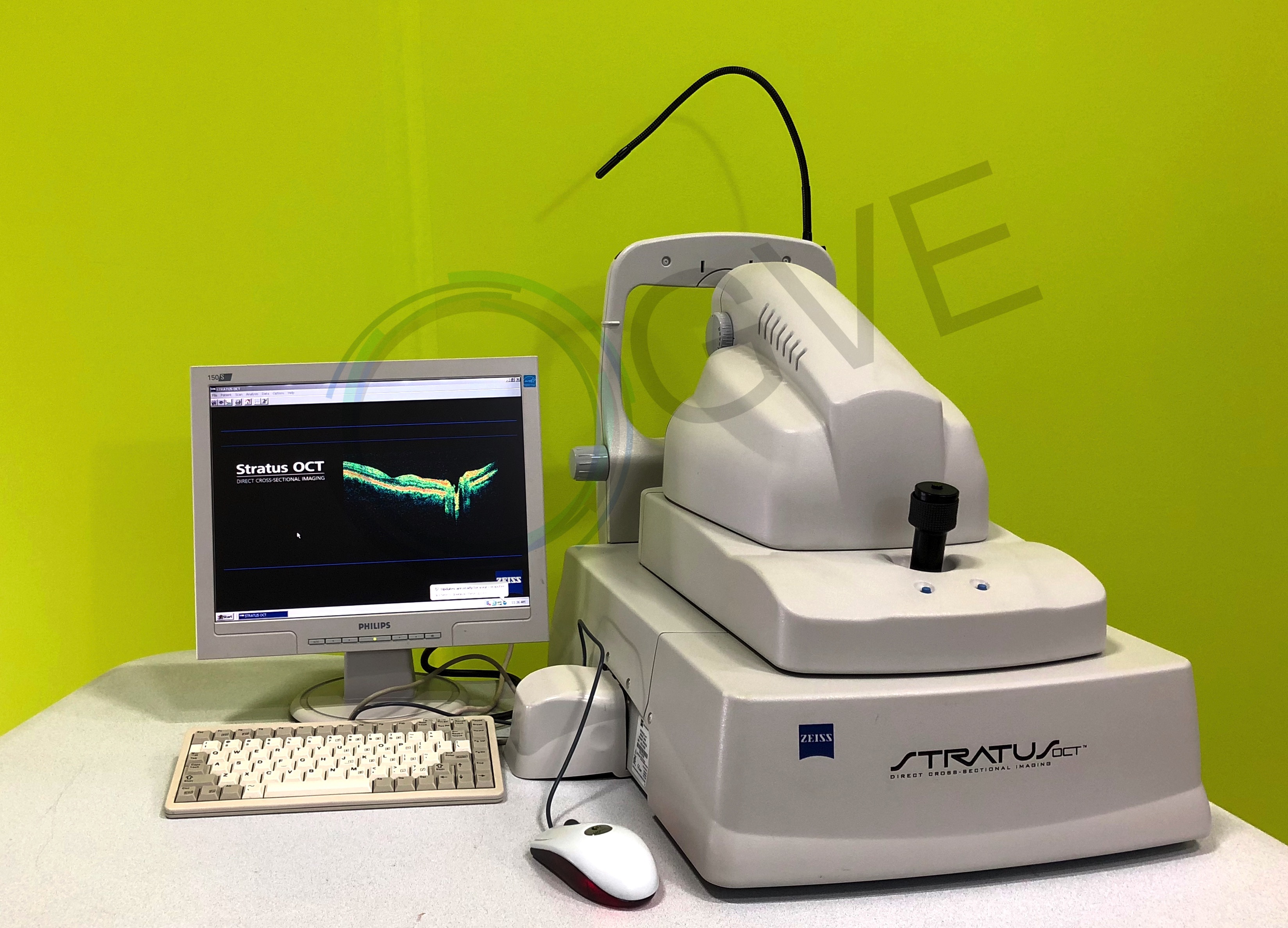 stratus optical coherence tomography stratus optical coherence tomography