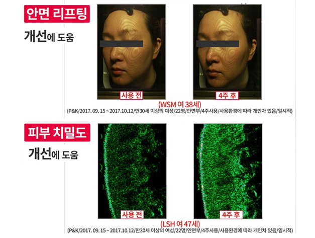 Thumbnail: Probiotics Mask Pack Season 3