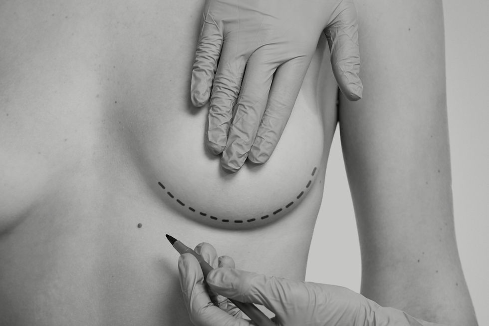 Can Breast Augmentation Help Restore Breast Volume Lost After Pregnancy or Weight Loss?