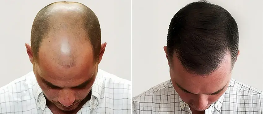 DHI South Africa Before-and-after 7