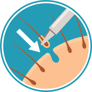 fue-placement-300x300.png