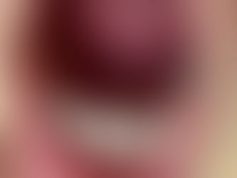 Retenção Prolongada dos Dentes de Leite: Quando os Pais Devem se Preocupar?