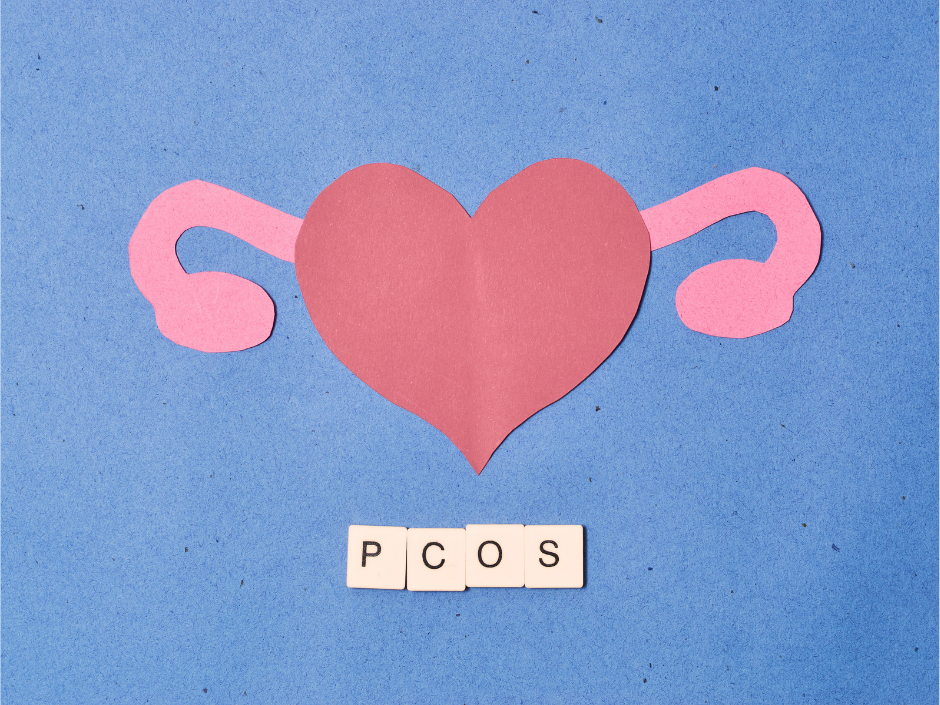PCOS: Why Knowing Your Subtype Changes Everything About Treatment