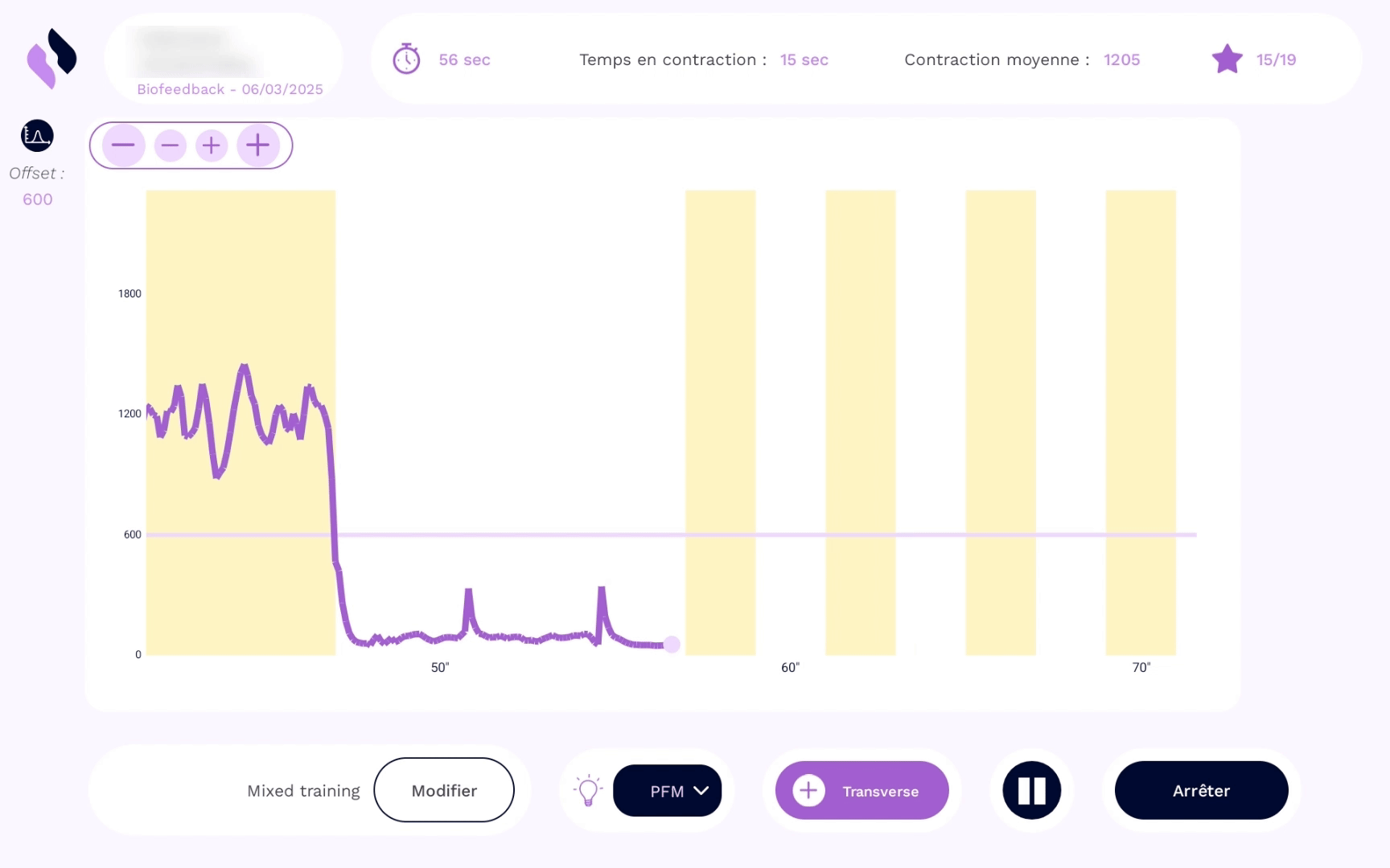 biofeedback périnée non invasif