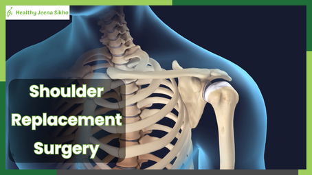 Understanding Shoulder Replacement Surgery: A Comprehensive Guide