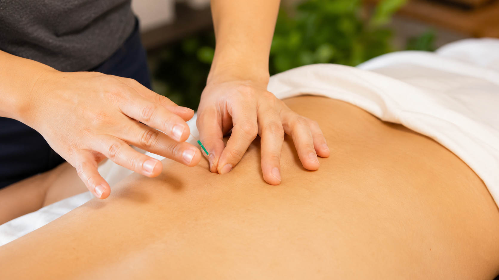 Dry needling at our Mohali physiotherapy centre