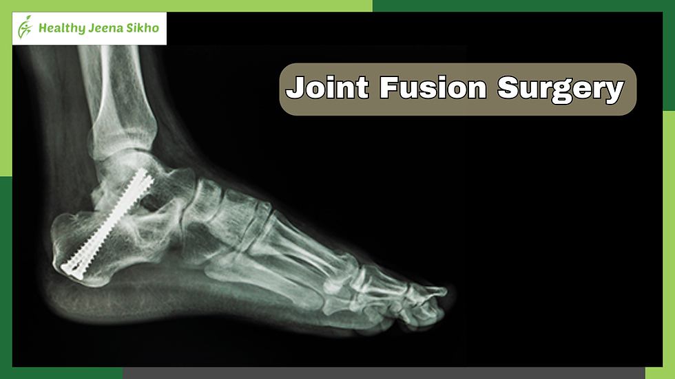 Image showing a surgical procedure of joint fusion surgery. A surgeon is working on fusing bones in a joint, typically in the ankle or spine, using medical tools. The image highlights the stabilization of bones with screws or plates to reduce movement and alleviate pain caused by severe arthritis or joint damage.