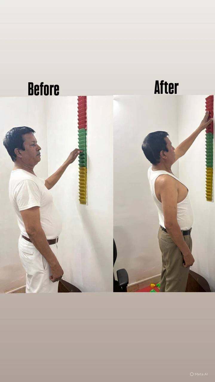 Exercise therapy space at the Sector 71 centre