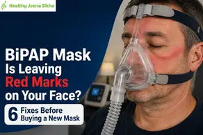 BIPAP mask leaving red marks?