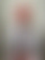 Dr. Gurdeep Singh(PT)