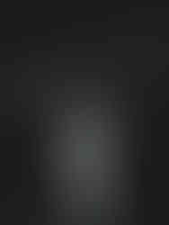 Bride and groom dancing under string lights at their backyard wedding