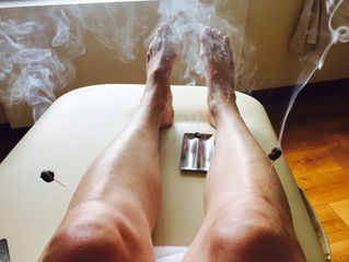 Acupuncture and Endometriosis