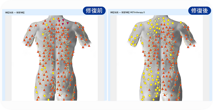 Metabio-biowaves tracer-生物波檢測-before_after17