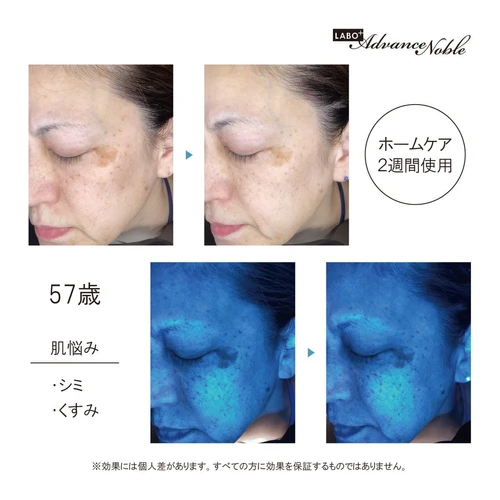 ラボプラス ADノーブル アメージング グロウオイル 25ml【店販用