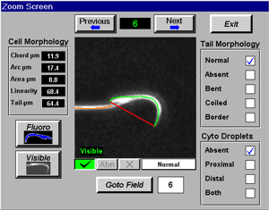 Rat Metrix Morphology.gif
