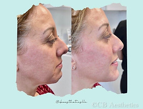 CB Aesthetics LLC (Ohio)