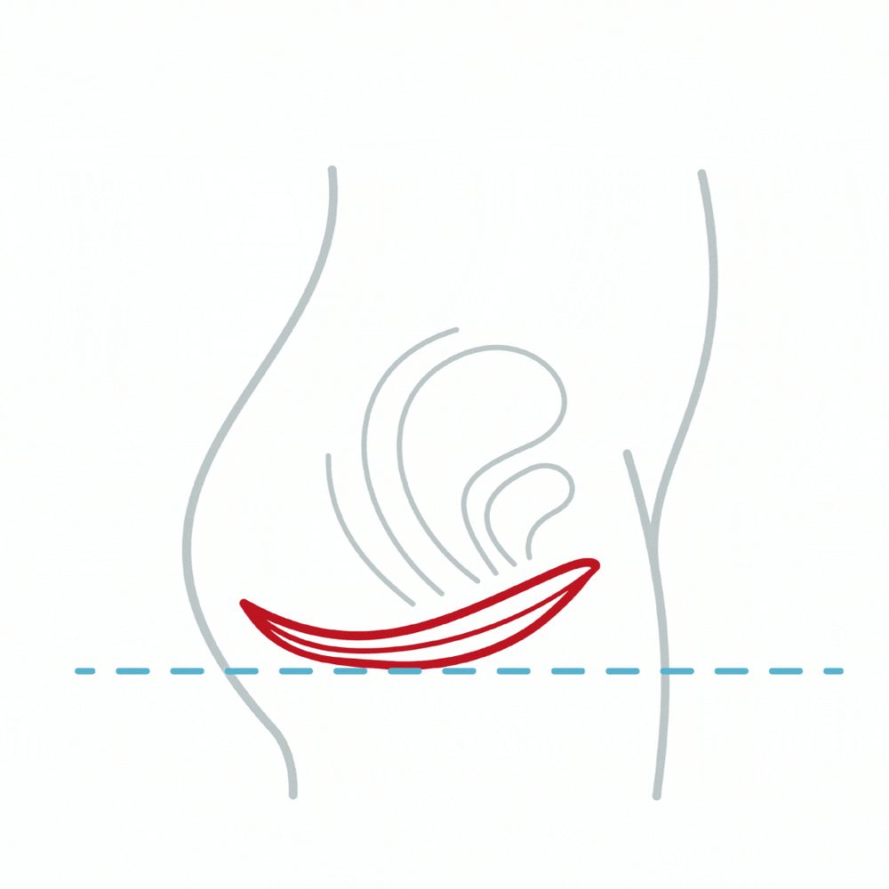3.gif