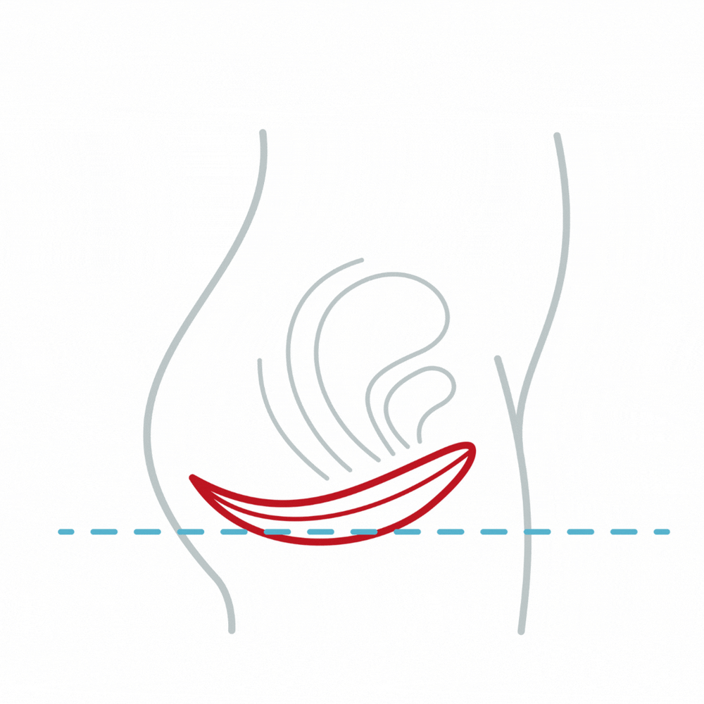 1.gif