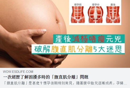 腹直肌分離的迷思