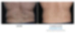 FL-P01M-2Set-17wk-HigherRez.jpg