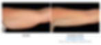 B&A-Dawes-AR-pt01F-2Set-10wks-Left-HiRes.jpg