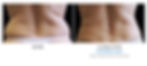 B&A-Fasano-FL-2Set-16wk-HiRes.jpg
