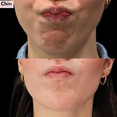 Dimpled chin V2.jpg