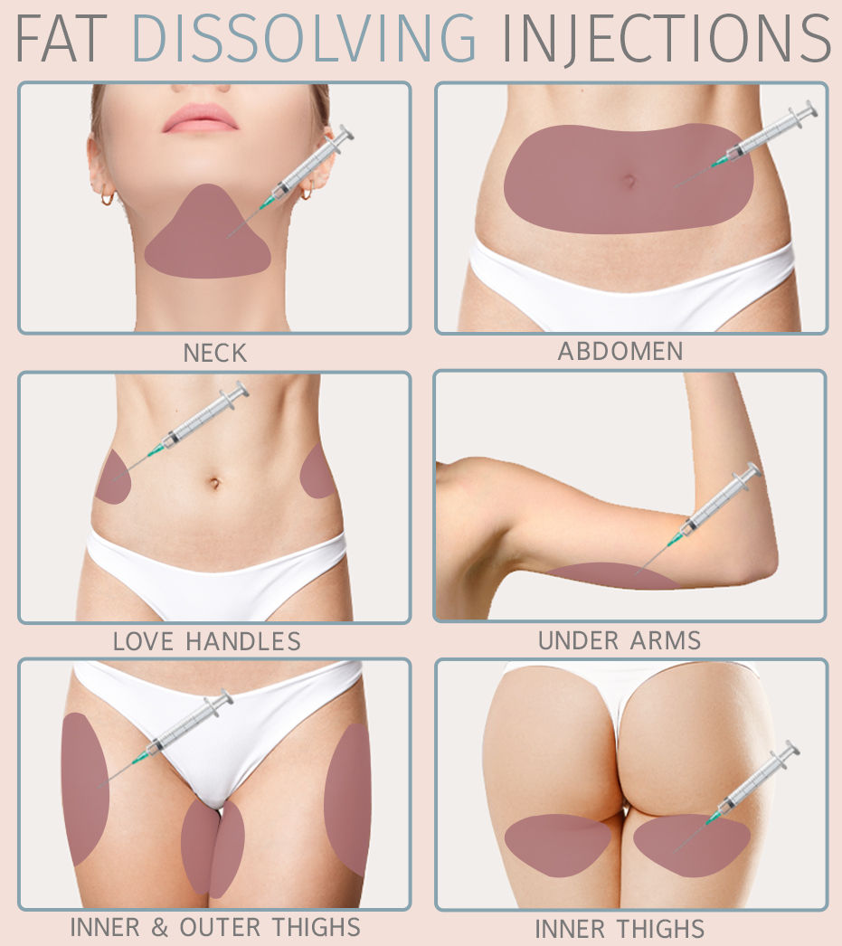 lipolysis injection 2
