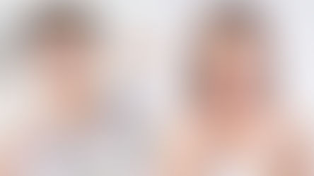 The Complete Guide to Choosing Between Braces and Invisalign