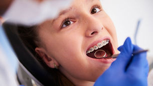 How Braces Have Changed Over the Years