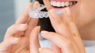 How Long Does Invisalign Take to Show Results?