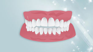 Why It Is Important to Treat and Fix an Open Bite