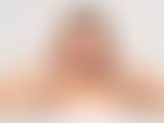 Common Questions About Cosmetic Procedures: What Are Your Concerns?