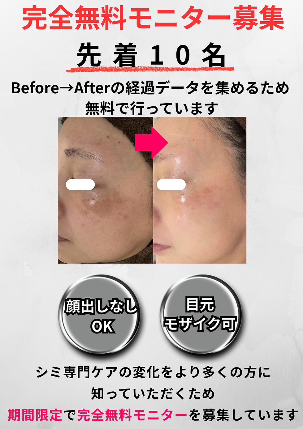 シミ専門の本格ケアで ワントーンアップした 透明美肌へ導きます。のコピー.png