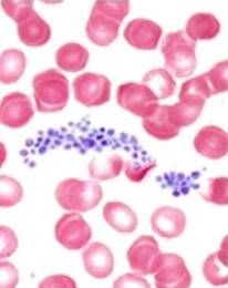imagem retirada do site: http://mmegias.webs.uvigo.es/a-imagenes-grandes/sangre.php